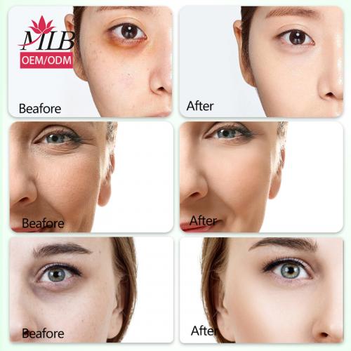 Skailie Aloe Vera Mascarilla de Colágeno para Ojos